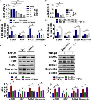 The MicroRNA MiR-29c Alleviates Renal Fibrosis via TPM1-Mediated Suppression of the Wnt/β-Catenin Pathway